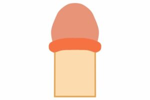カントン包茎のイラスト