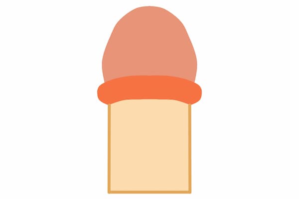 カントン包茎のイラスト