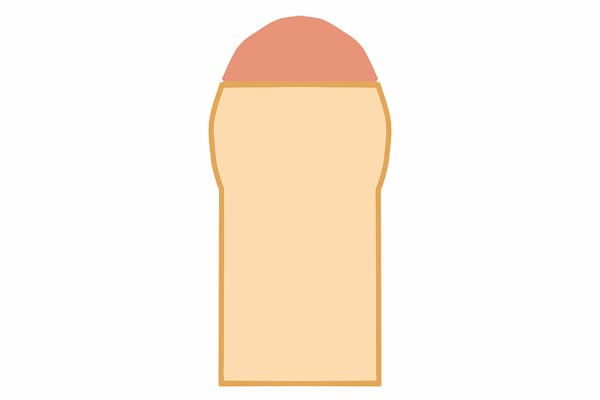仮性包茎のイラスト